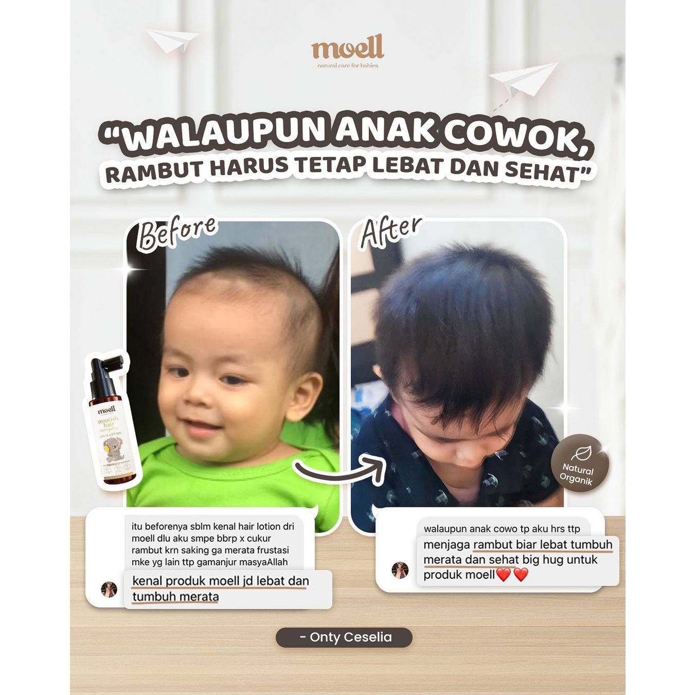 Moell Hair Lotion Bayi Anak 100 ml | Penumbuh Rambut Bayi &amp; Anak Bebas Alkohol