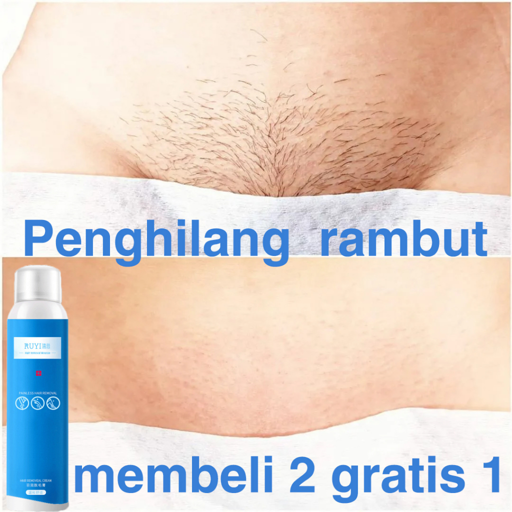 100%ASLI Spray Cream Krim Penghilang bulu permanen 150ml rambut Hair removal cream Rambut ketiak Penghilang bulu Bagian privat kaki Lengan Krim penghilang rambut cepat yang aman, tanpa rasa sakit, lembut dan tidak menyebabkan iritasi