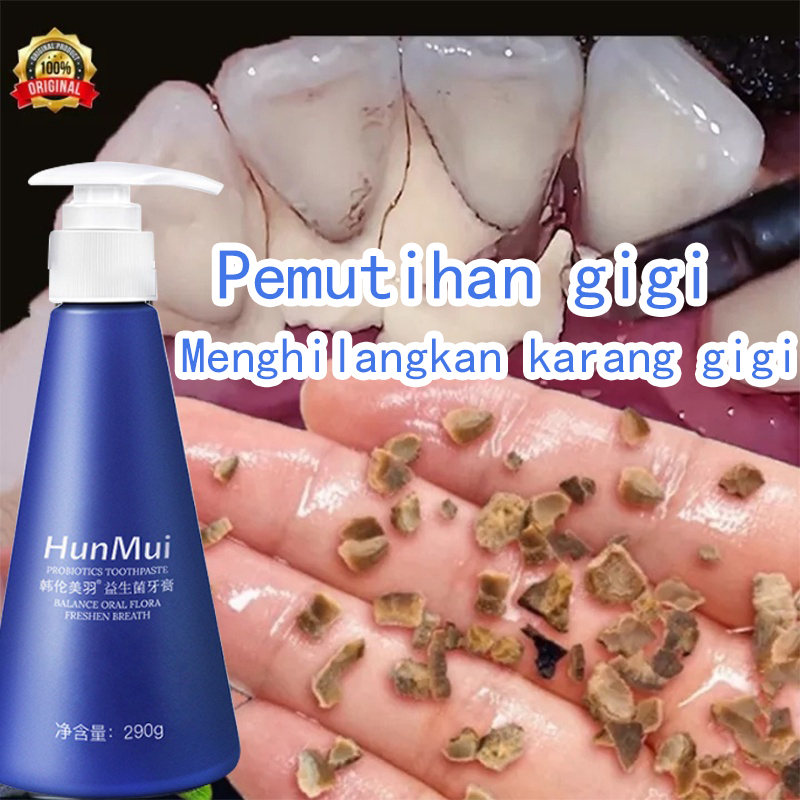 Pembersih karang gigi Pemutih gigi probiotik odol Pemutih gigi dan karang gigi Pemutih gigi permanen Teeth whitening pemutih gigi dan penghilang karang gigi pasta gigi pemutih Perawatan Pemutihan Gigi/Menghilangkan Gigi Kuning/Perlindungan gigi