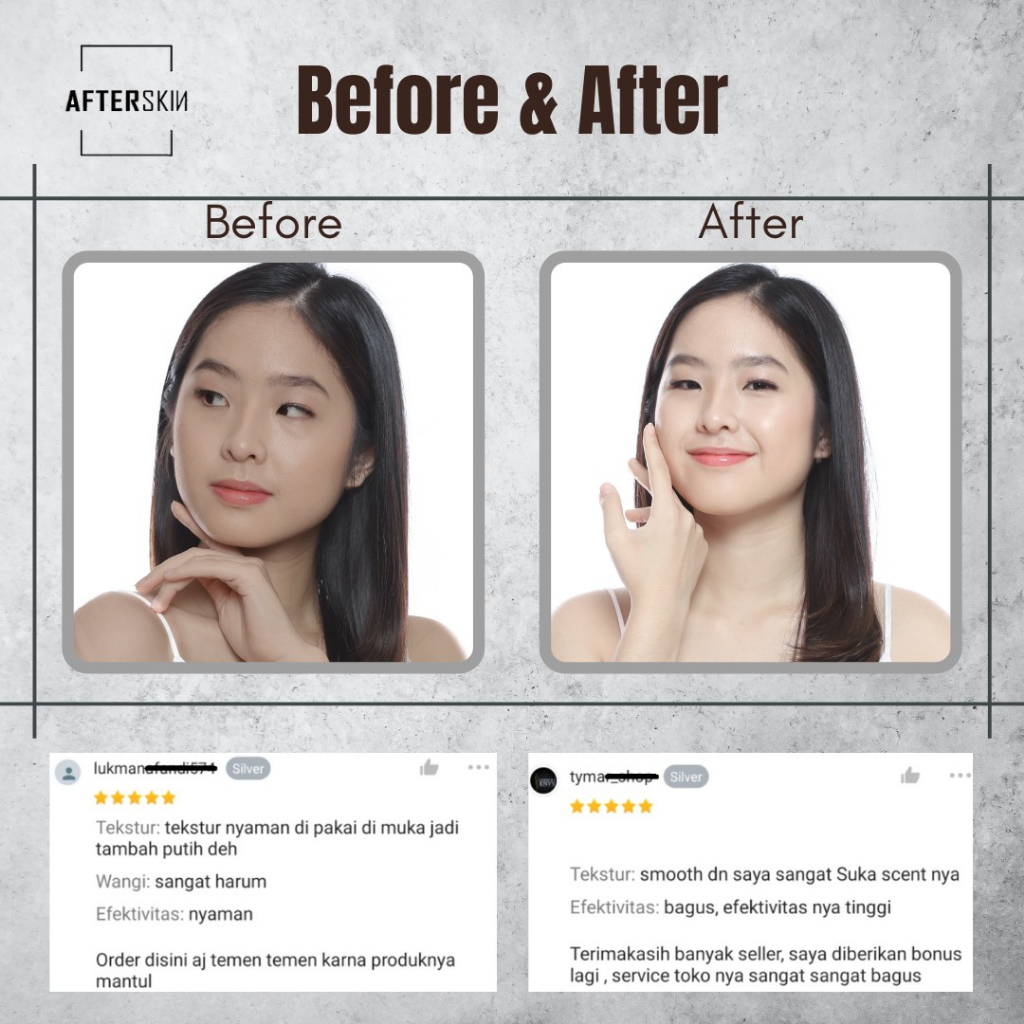 [COLLAGEN SERUM] AFTERSKIN WHITENING SERUM ALA KOREA BPOM HALAL / SKINCARE WAJAH PEMUTIH DAN PENCERAH