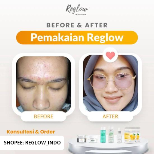 [BONUS TAS] Reglow Skincare Original Glow Skin Treatment Paket Wajah Glowing Whitening Skincare Penghilang Bruntusan Bekas Jerawat Flek Hitam Pemutih Wajah Perawatan Kecantikan Re Glow Beauty Skin Care dr Shindy Putri Reg glow Riglow Official Store