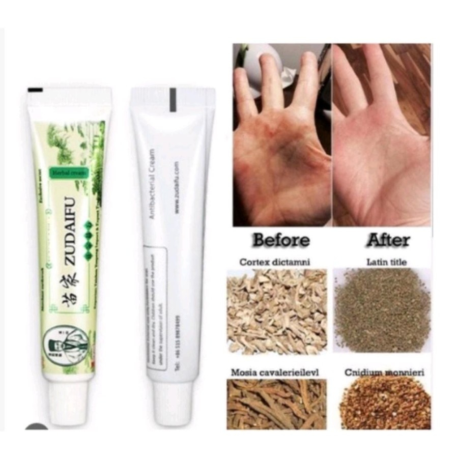 (UMU SUPPLIER) ZUDAIFU SALEP OBAT ORIGINAL UNTUK ALERGI GATAL JAMURAN JERAWAT EKSIM PSOARISIS