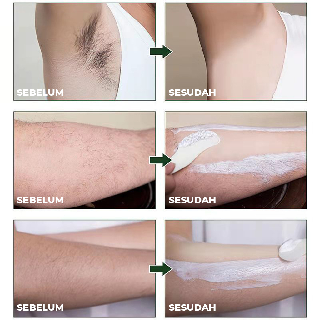 Krim Penghilang Bulu Hair Removal Cream Perontok Bulu Ketiak Kaki Lainnya Aman Lembut | GROSIRXPRESS