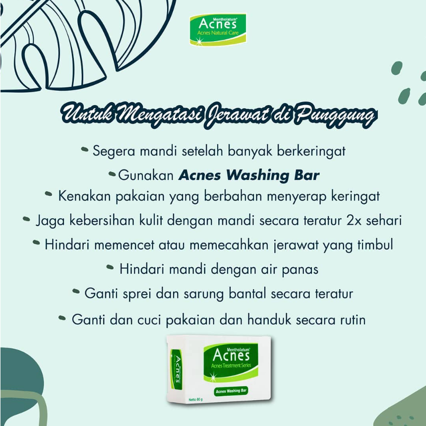 [BPOM] Acnes Washing Bar 80 gr / Acnes Sabun Batang / Sabun Wajah / Sabun Jerawat / Acne Bar Soap / MY MOM