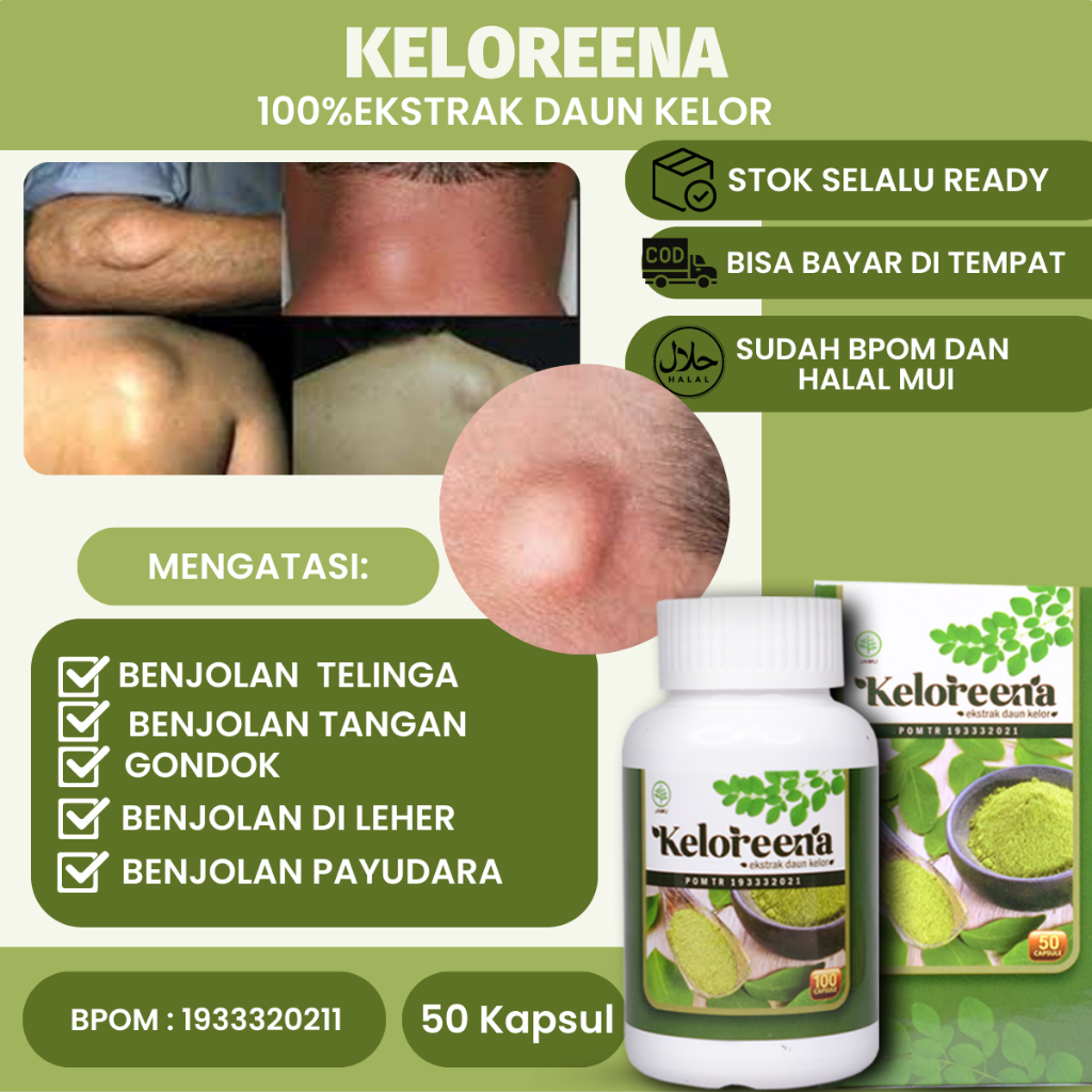Obat Penghancur Benjolan, Benjolan Di Leher, Gondok, Benjolan Payudara, Penghancur Benjolan di tanga
