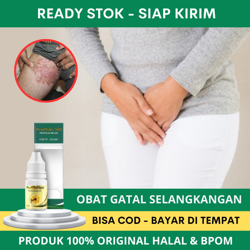 Obat Gatal Selangkangan, Obat Gatal Selangkangan Hitam dan Gatal, Obat Gatal Selangkangan Pria Wanit