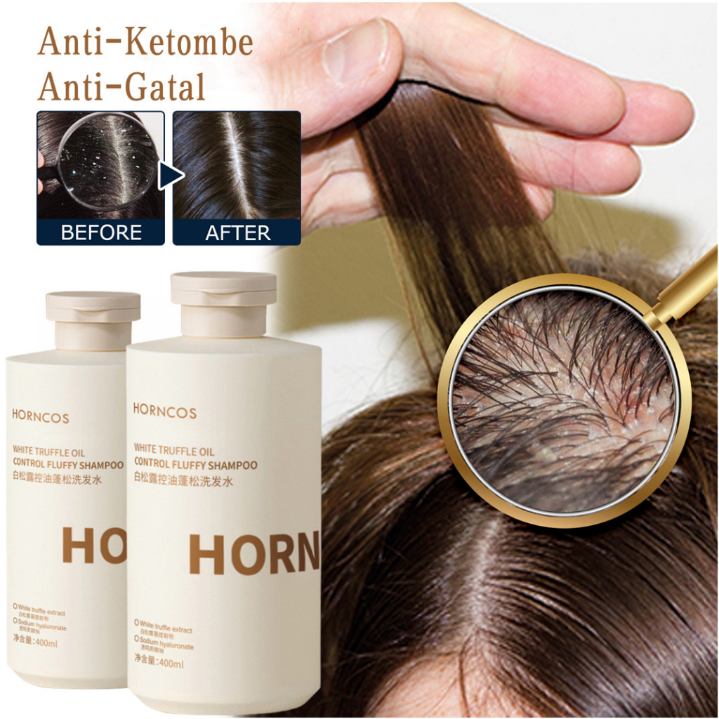 Shampo Anti Ketombe &amp; Anti Gatal dan Mencegah Rambut Rontok Sampo Kontrol Minyak Garam Laut Shampoo Anti Tungau 400ml Original