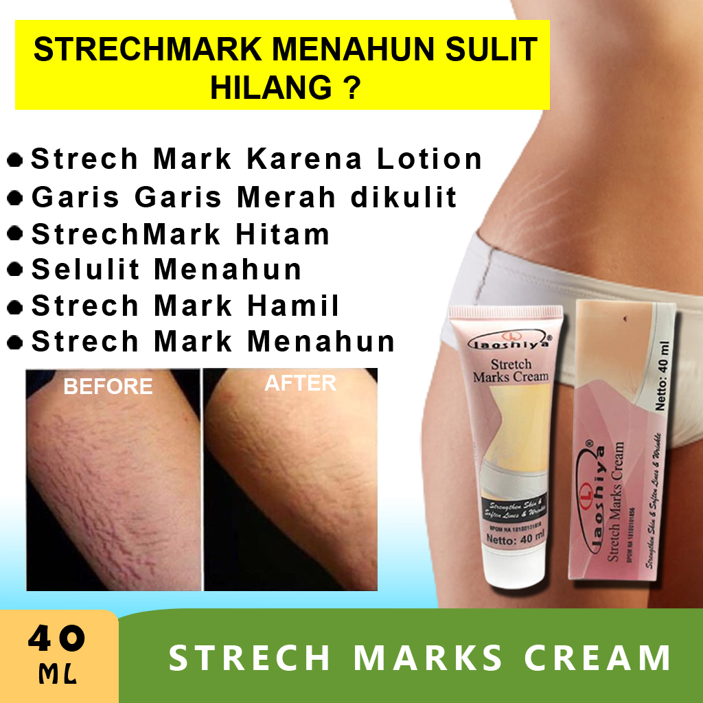 Cream obat Penghilang strechmark stretch mark cream paling ampuh BPOM