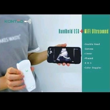 USG wireless konted ultrasound
