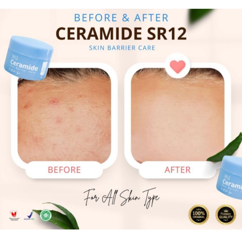 SR12 CERAMIDE SKIN BARIER CARE/ MOISTURIZER  GEL 7X CERAMIDE DAN NIACINAMIDE/MOISTURIZER KULIT SENSI