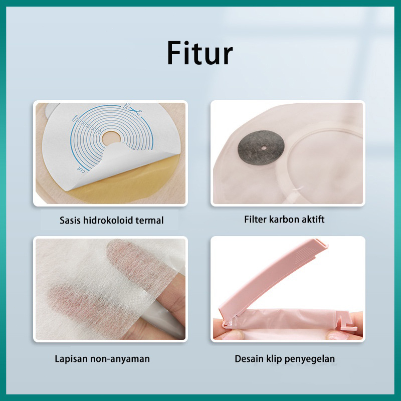 10Pcs Satu Potong Sistem Diaktifkan Filter Karbon Kantung Kolostomi Penghilang Bau Knalpot Stoma Kantong Colostomy Ostomy Tas Cut UKURAN 20Mm-65Mm Beige Cover-A002