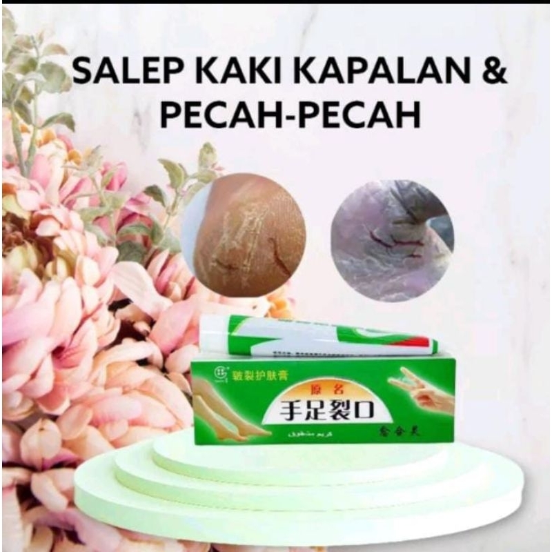 Salep Kaki TIANGE Atasi Tumit Kaki Tangan Eksim Pecah