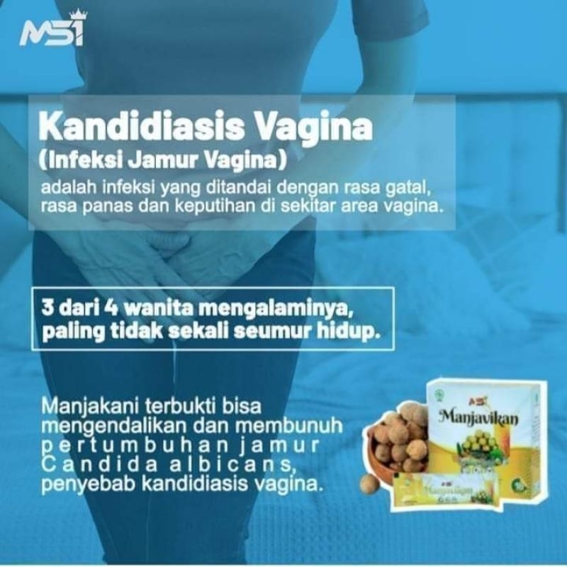 

MANJAVIKAN dan MANGBROTO MSI