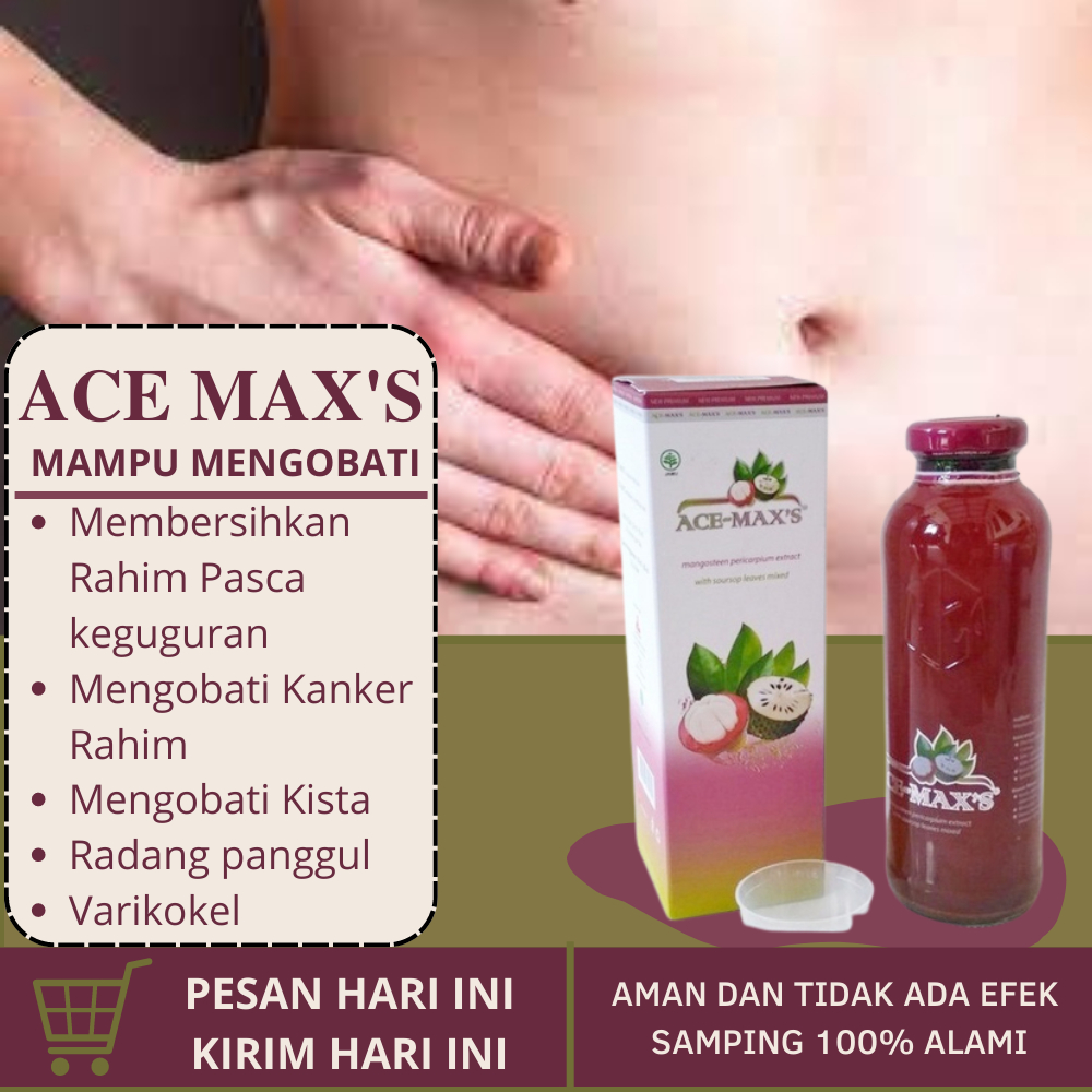 Ace Max's Obat Herbal Mengobati Hernia Turun Berok Dewasa Paling Ampuh