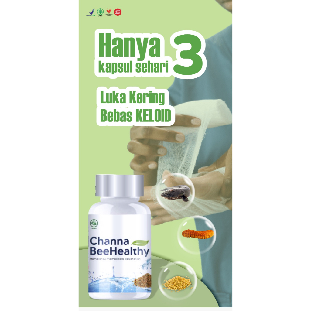 Kapsul Channa BeeHealthy Isi 60 - Ekstrak Ikan Kutuk Premium Lebih Cepat Kering Luka Pasca Operasi - Herbal Original