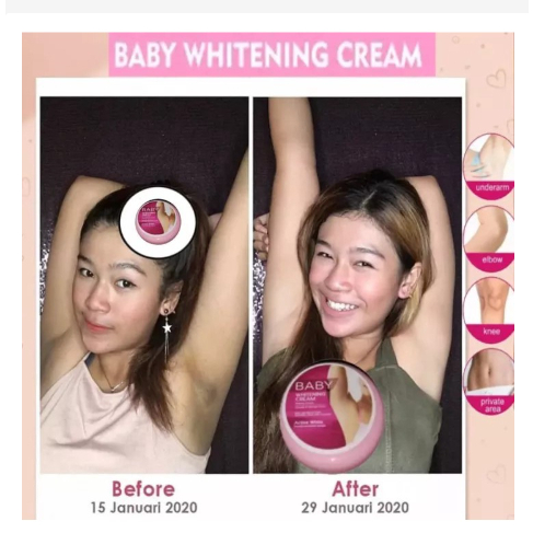 NR Baby Whitening Krim  20gr/Cream Pemutih Badan Leher Ketiak dan Selangkangan /Krim pemutih ketiak hitam