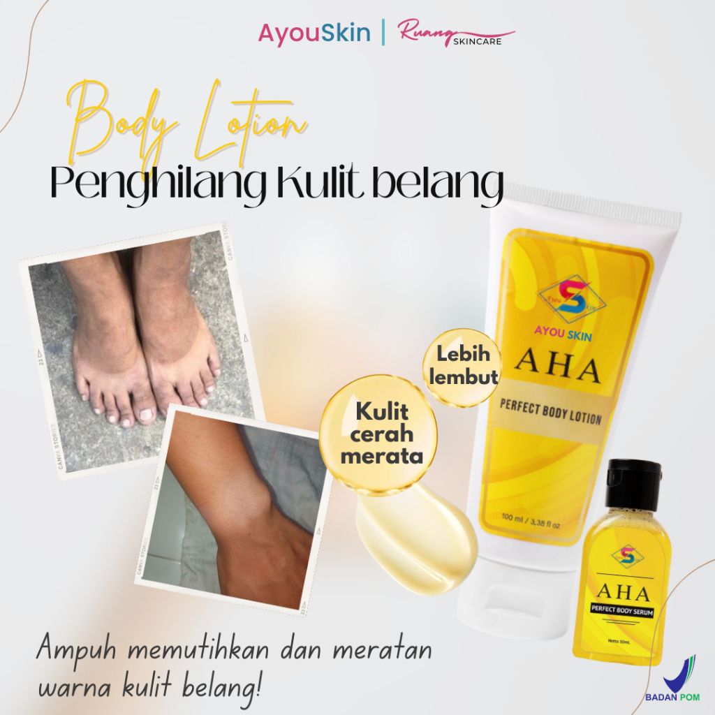 Body lotion pemutih kulit belang, handbody pencerah kulit belang, UV protection, pencerah tangan dan