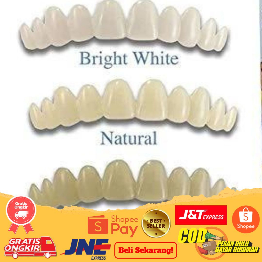 Gigi Palsu Veneer White | Not Snap On Smile | Perapih Gigi Vener White Original | Gigi Bolong | Gigi Patah | Gigi Kuning | Gigi Rusak COD Gigi Palsu Snap On Smile Venner White Gigi Palsu Terlaris