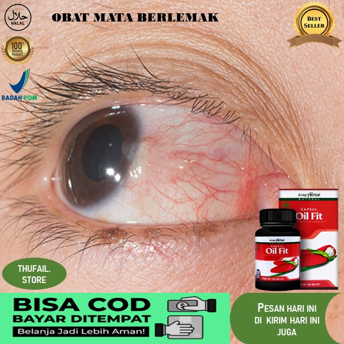 obat mata berlemak  Obat Mata Berlemak Obat Mata Berlemak, Pembersih Pterigium, Pterygium, Penghilan