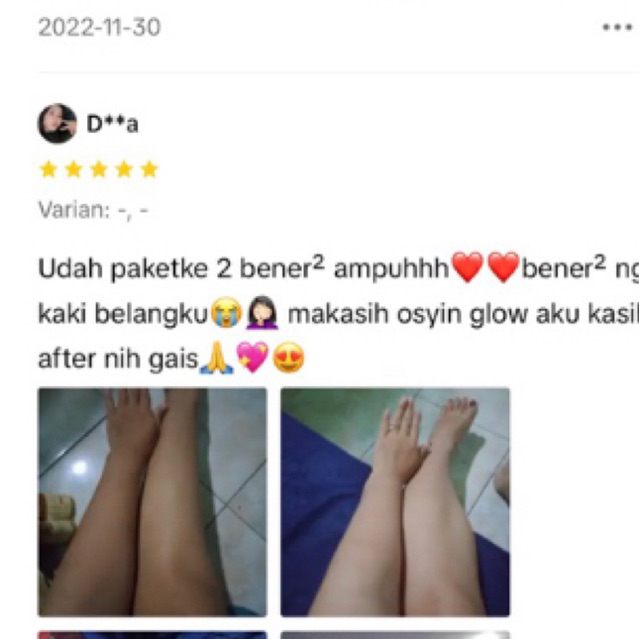 BPOM lotion hb dosting osyin glow racik pemutih badan ampuh penghilang bekas luka bibit pemutih anggur globe