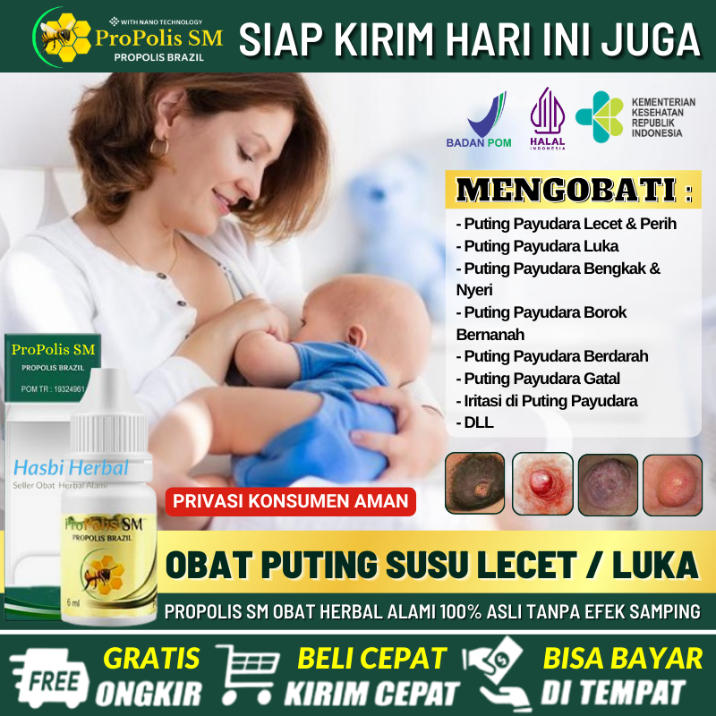 Obat Oles Penutup Luka Lecet di Puting Payudara Aman Jika Tertelan 100% Alami, Obat Pengering Puting