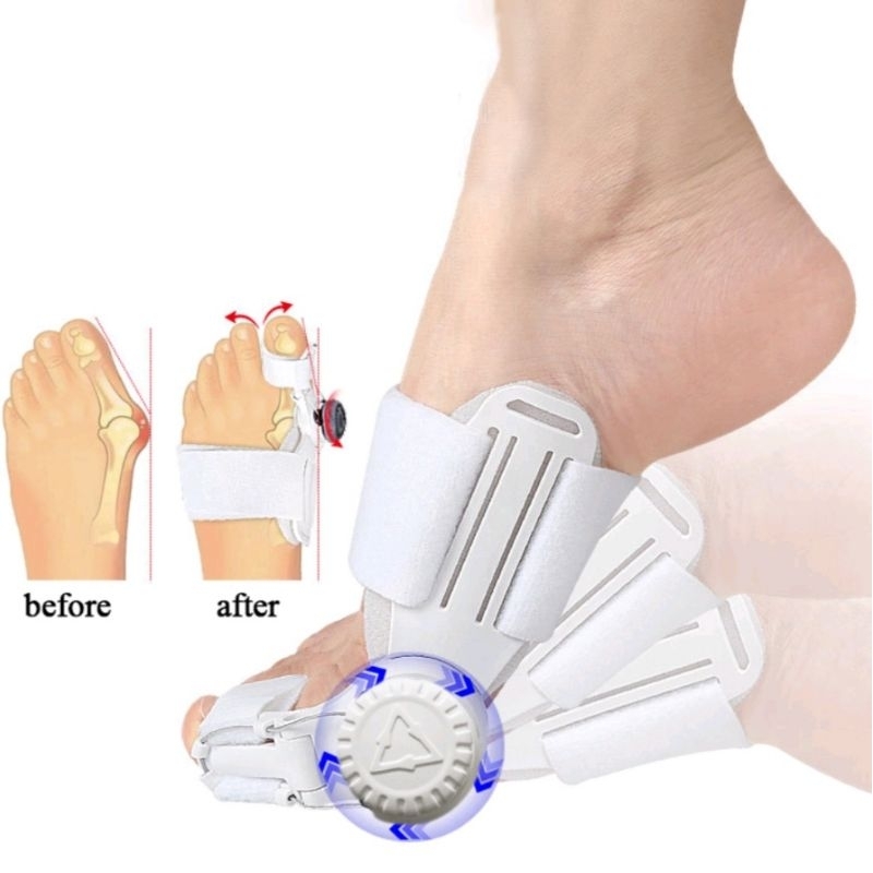 Bunion Splint Big Toe Straightener / Pelurus Jempol Kaki / Bunion Corrector