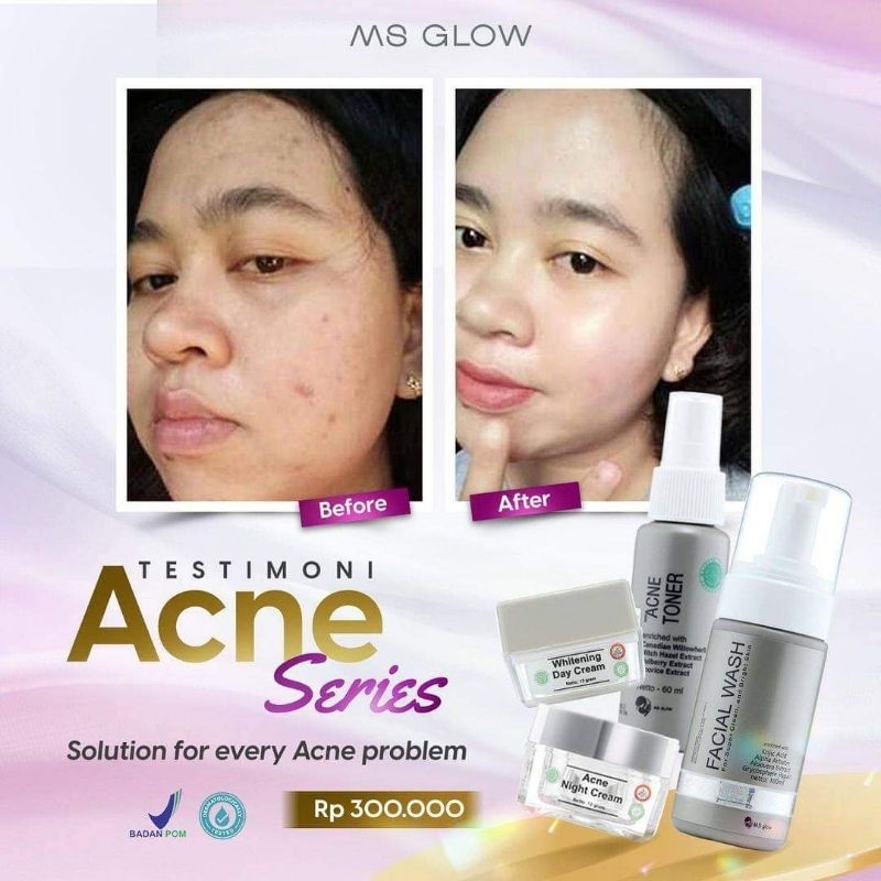 ACNE SERIES MS GLOW PAKET LENGKAP ACNE ORIGINAL100% BPOM