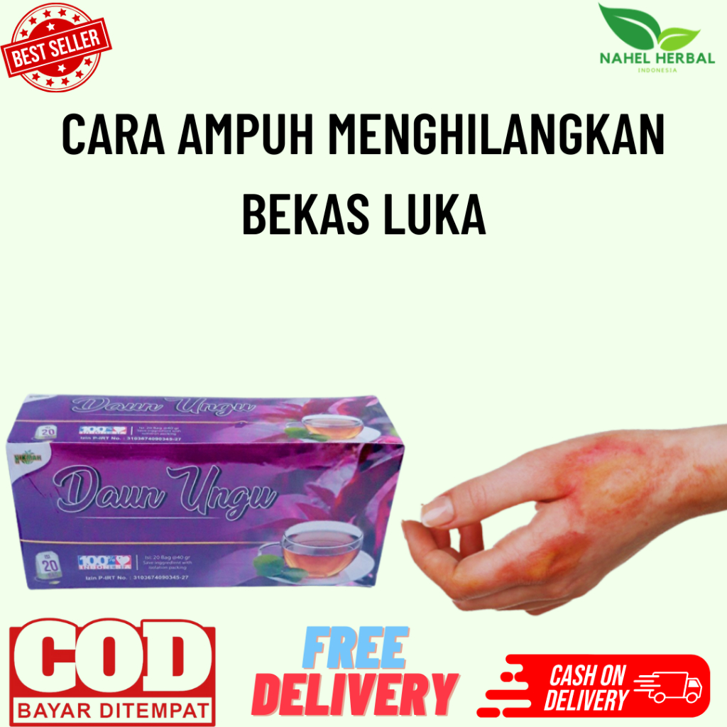 [Cod] Teh Celup Daun Ungu Hikmah Original - Obat Luka/Keloid Hitam Dan Gatal Di Kaki Anak Dan Remaja