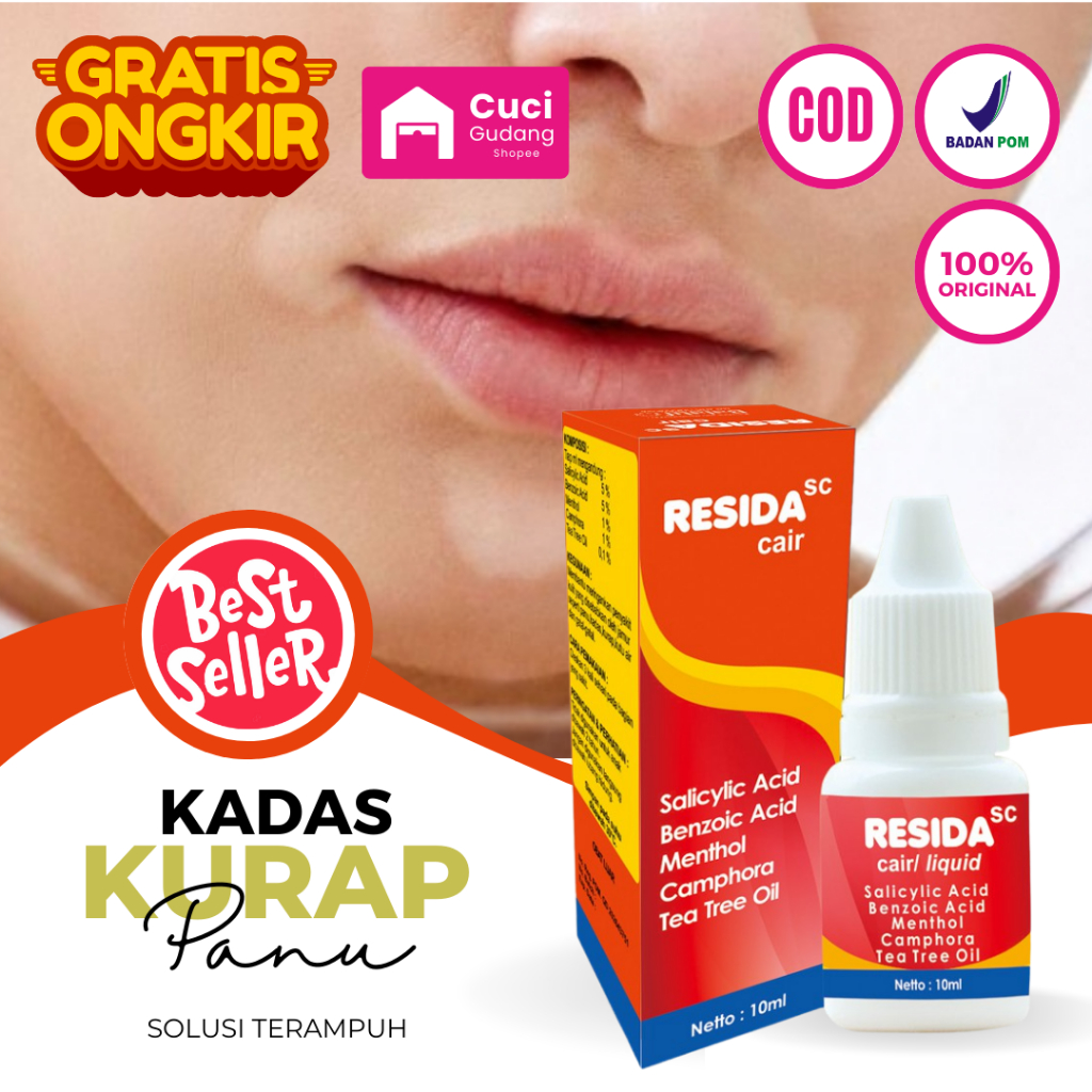 Resida Cair Obat Panu Original Obat Panu Paling Ampuh 100% Cair Original Bpom Penghilang Gatal Untuk