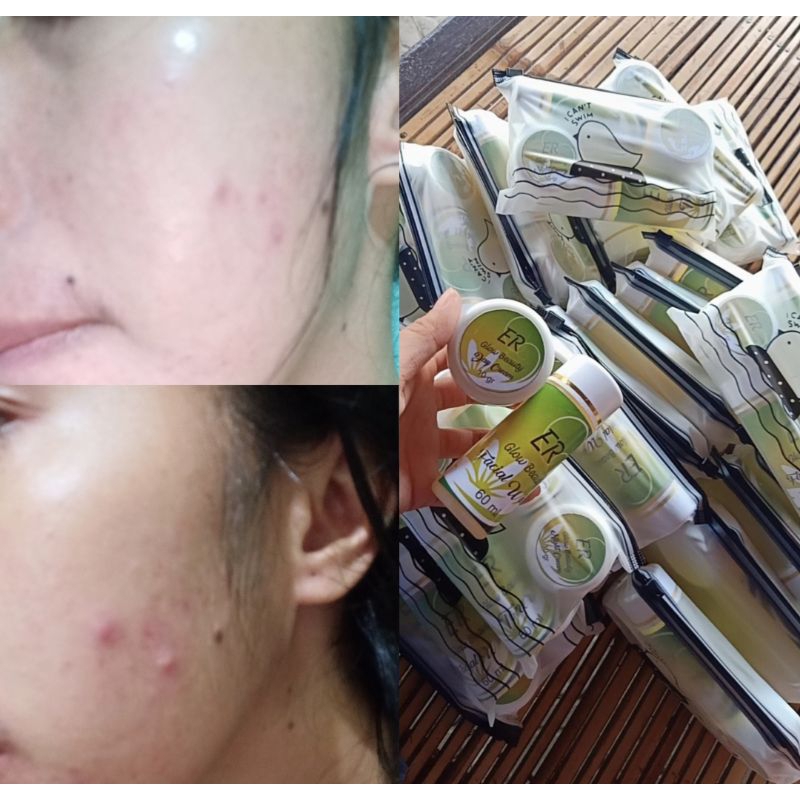 ER Glow Beauty Cream Pemutih Wajah