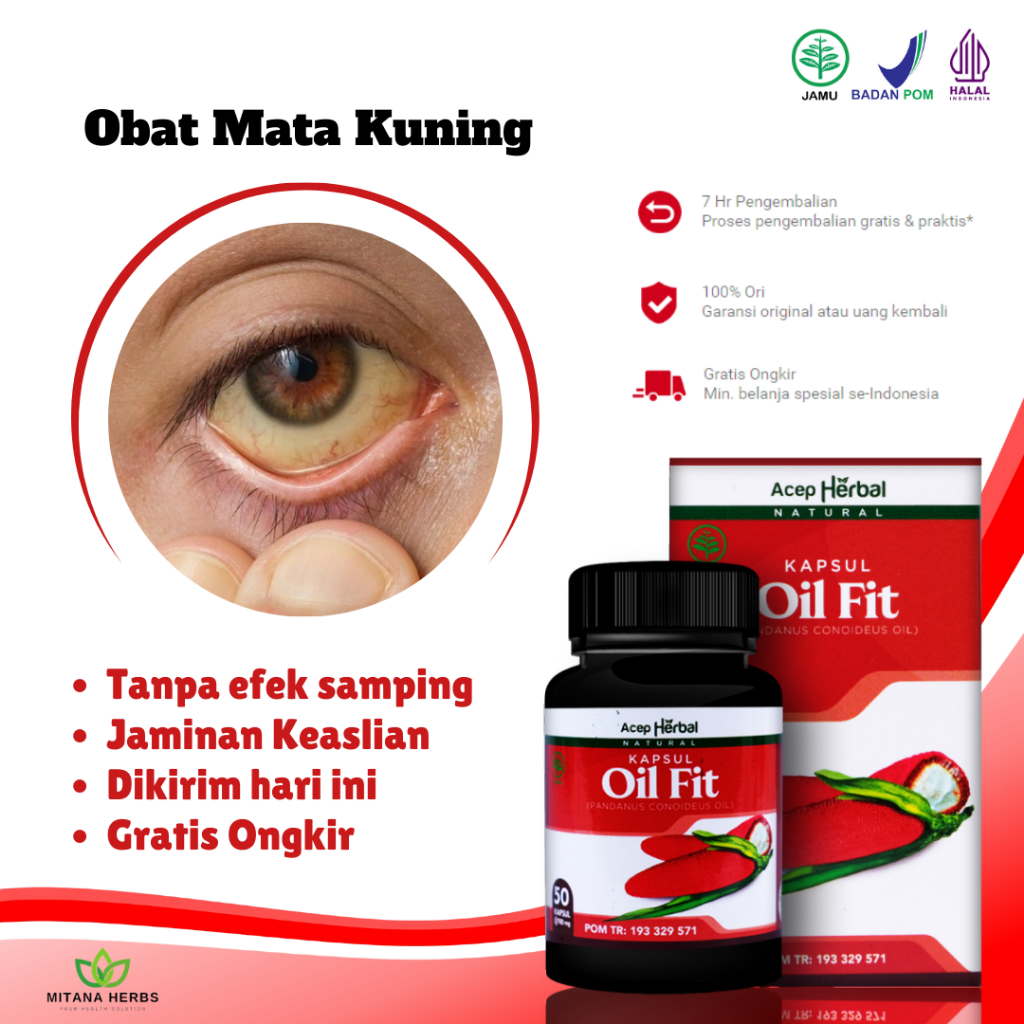 Obat Mata Kuning, Obat Mata Berlemak, Obat Mata Kuning Jadi Putih, Obat Mata Pterigium