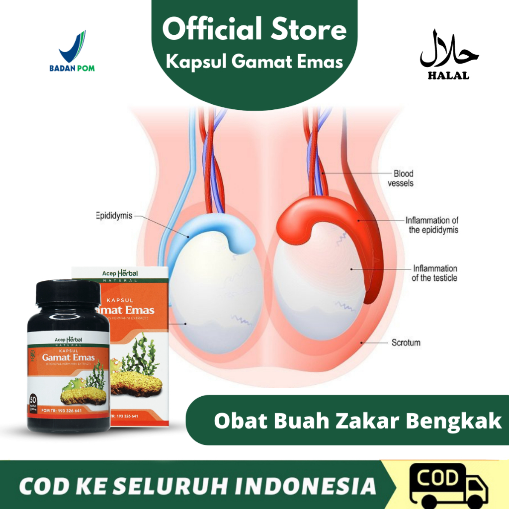 Obat Buah Zakar Bengkak, Varikokel, Infeksi Saluran Kemih, Nyeri Saat Kening, Testis Besar Sebelah, 
