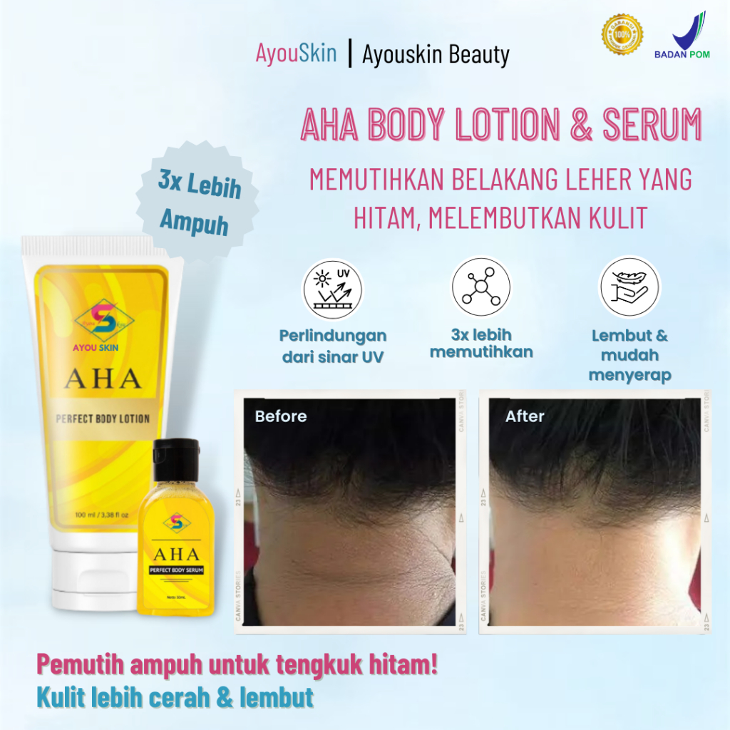 Krim pemutih belakang leher hitam, pencerah belakang leher/tengkuk/punduk gelap, pembersih daki di p