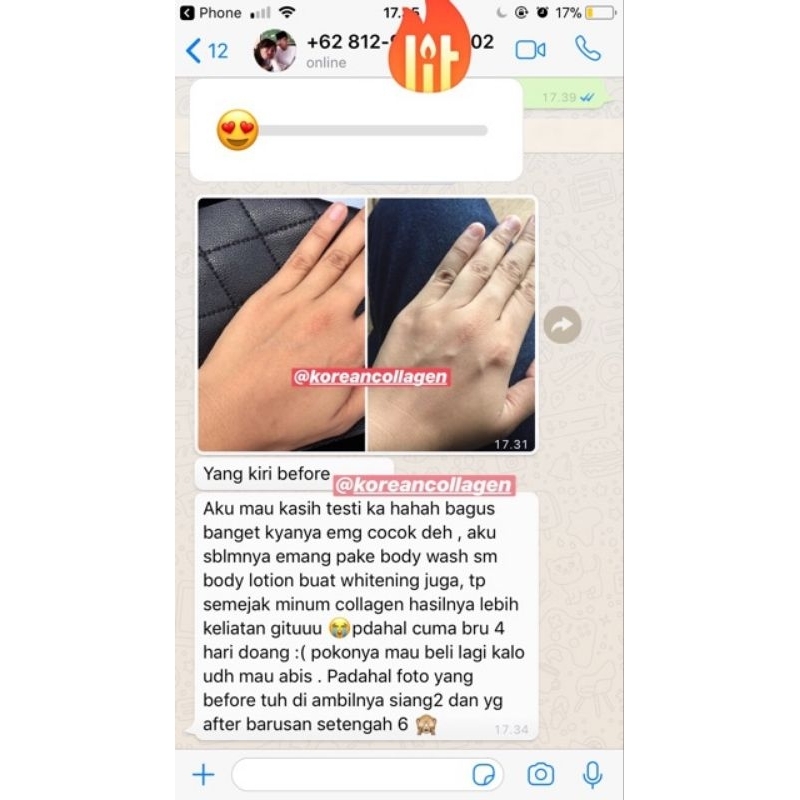 ED LAB COLLAGEN Minuman Pemutih Tubuh &amp; Badan Terdaftar BPOM