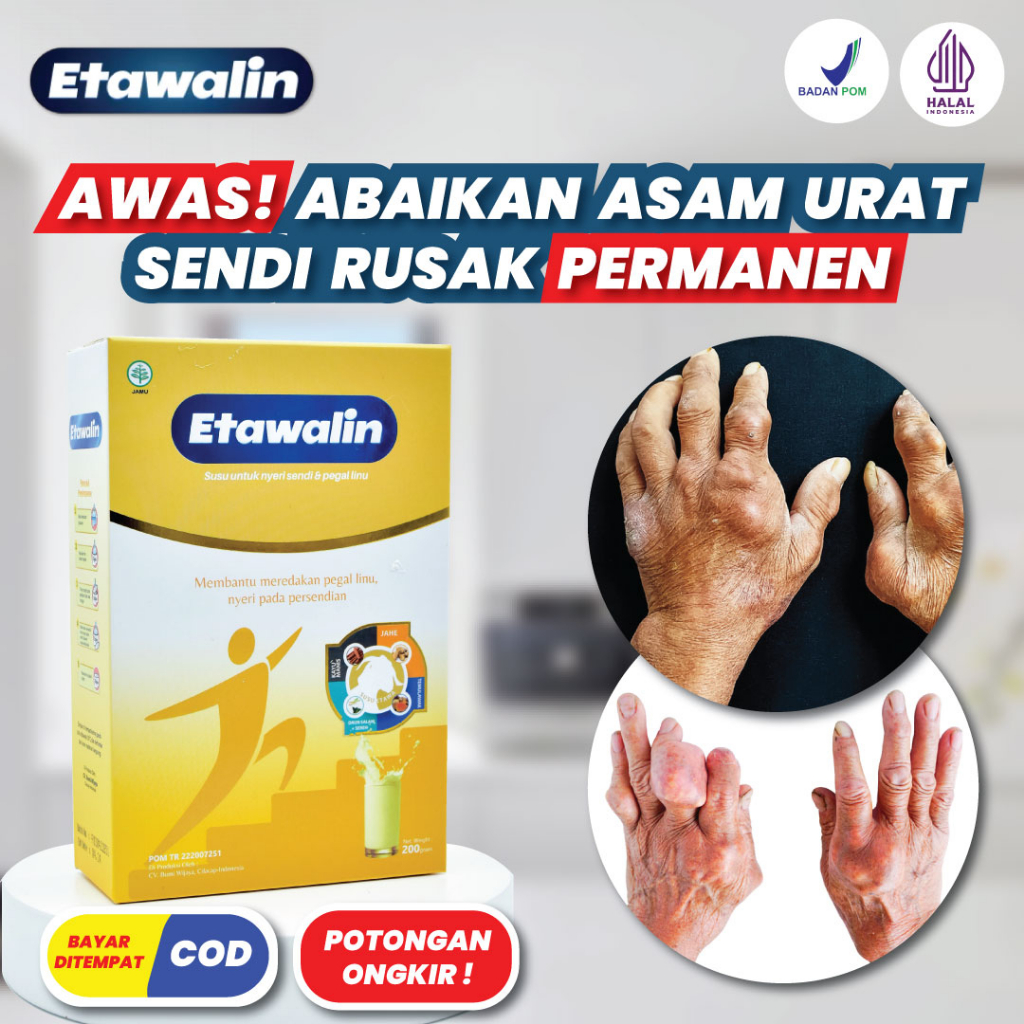 

ETAWALIN Original - Susu Etawa Bubuk Original Atasi Asam Urat Nyeri Pinggang Sendi Lutut Osteoarthritis Rematik Menjaga Kesehatan Tulang dan Sendi Tanpa Efek Samping Terlaris Garansi 100% Terampuh Terjamin Berkualitas Halal MUI BPOM