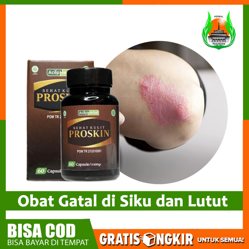 Obat Gatal di Siku Tangan dan Lutut Kulit Siku Kering dan Bersisik Herbal Sehat Kulit Proskin Kapsul