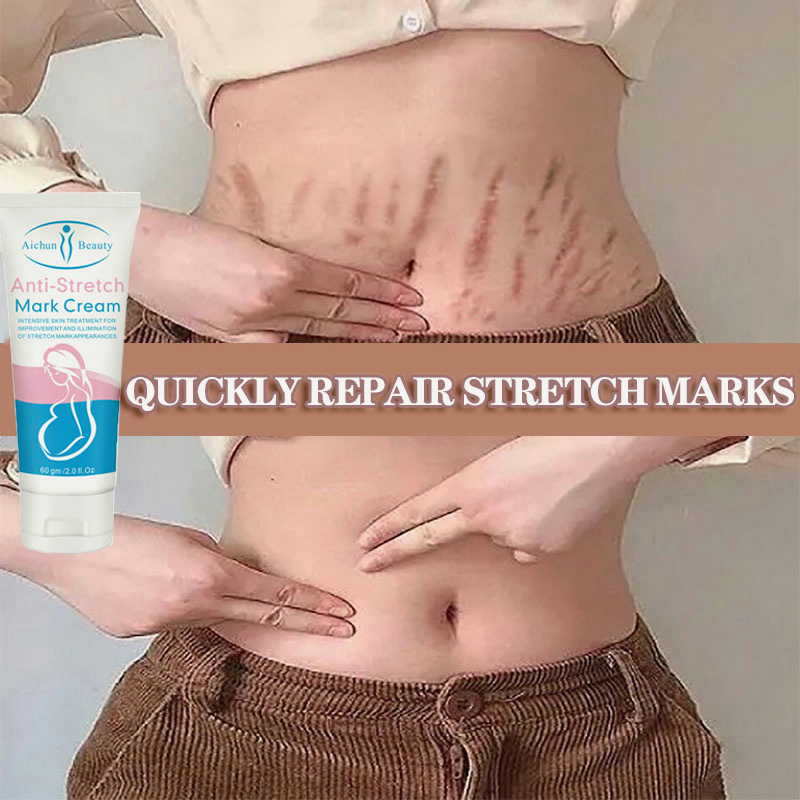 【ORIGINAL】STRECHMARK CREAM Krim Stretch Mark Pascamelahirkan PENGHILANG STRECHMARK KRIM STRETCH MARKS 60g Menghilangkan stretch mark saat hamil PERAWATAN TUBUH