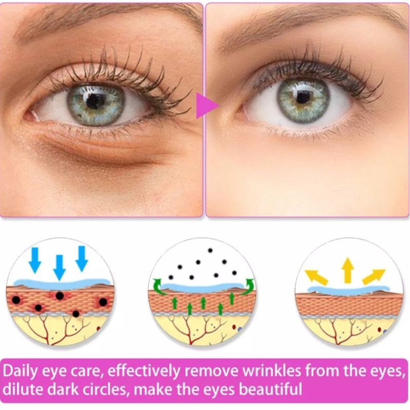 RTOPR MANGO VITAMIN C HYDRATING EYE
