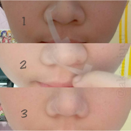 FL⚡SH SALE Sticker Pembentuk Wajah Selotip Penarik Kulit Waterproof v shape Face Lift tape tanpa ope