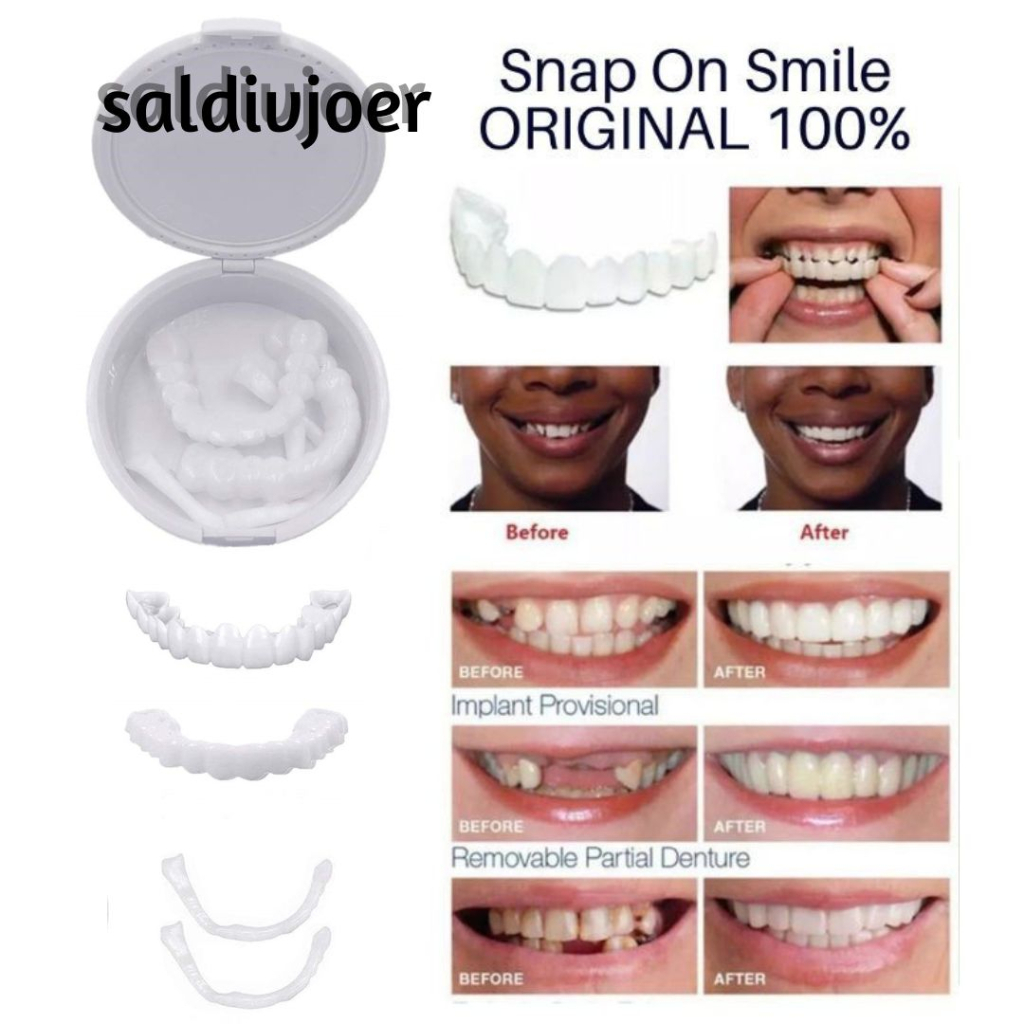[ COD ] Snap On Smile Gigi Palsu 1 Set Atas Bawah Gigi Venner Putih Bersih - Instan Perfect Smile Veener Gigi Palsu Original