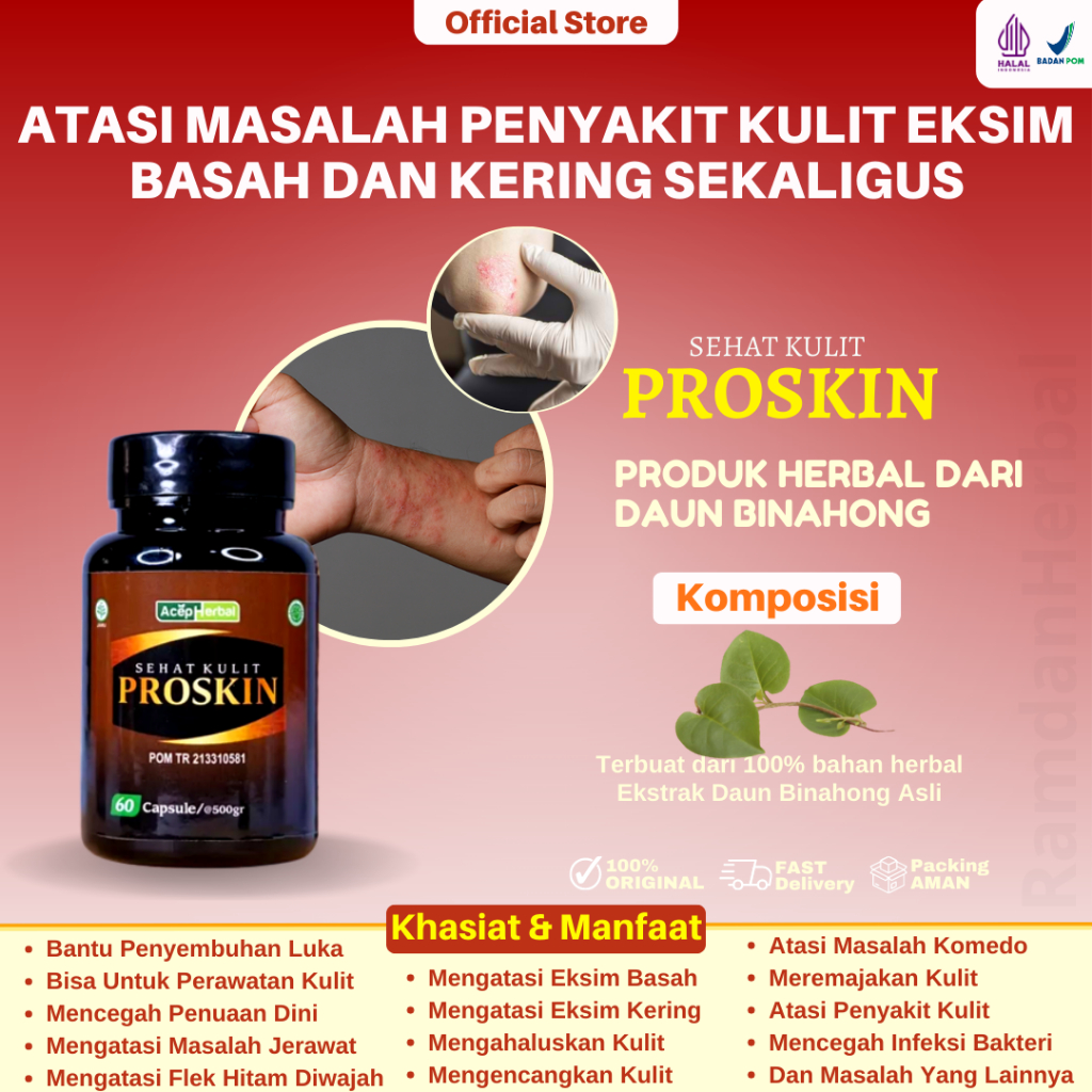 Obat Herbal Exim Basah Menahun Gangguan Kulit Penyakit Kulit Eksim Basah Dermatitis Atopik Proskin E