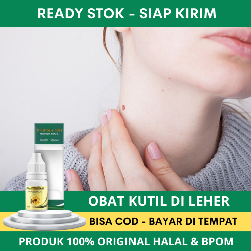 obat kutil - obat kutil di leher - obat kutil leher - obat kutil kelamin - obat kutil wajah - obat p