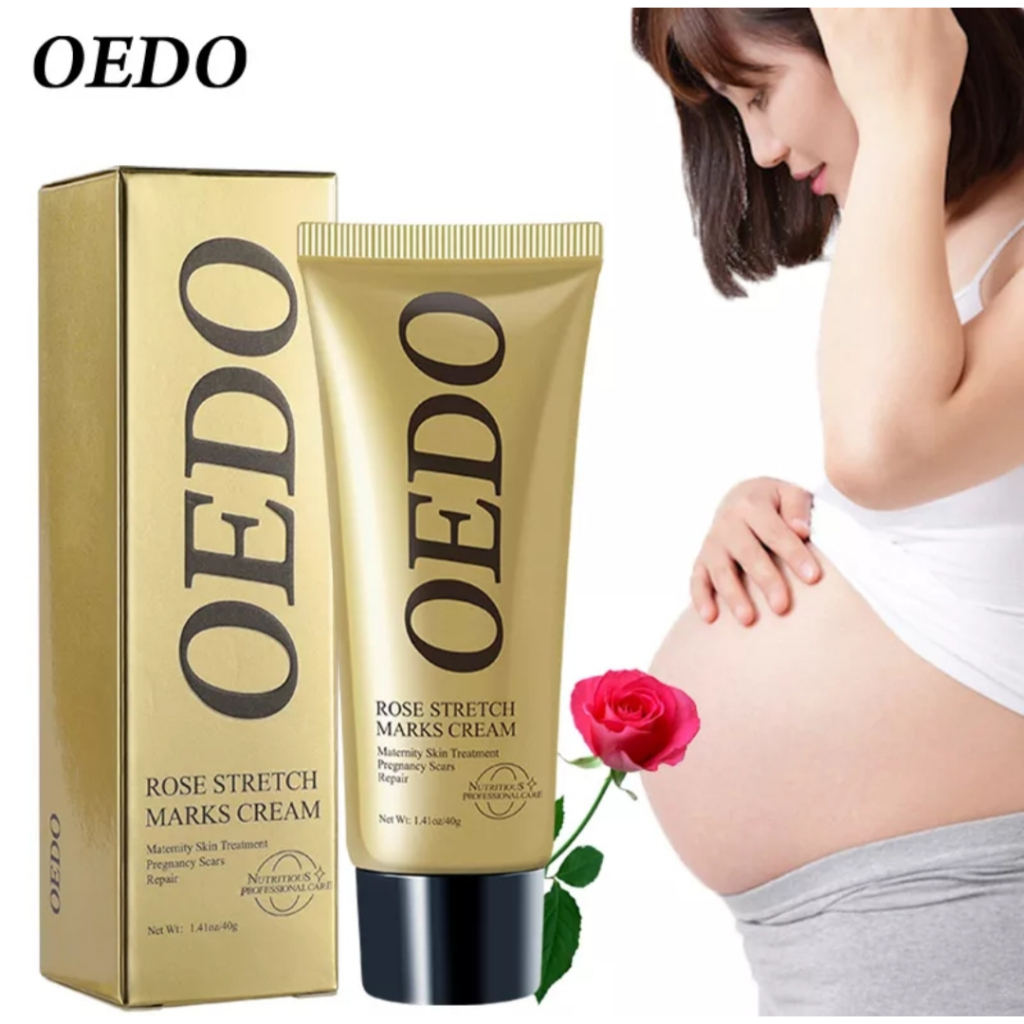 ORIGINAL 100% OEDO KRIM PENGHAPUS STRETCH MARKS PERUT PAYUDARA KAKI/KRIM BERSALIN MENGHILANGKAN BEKA