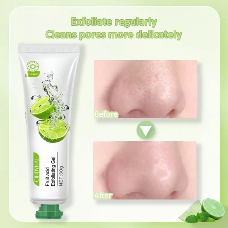 Peeling Wajah Fruit Acid Exfoliating Gel 30 Gr Facial Glowing CINDYNAL EXPOLIATING GEL