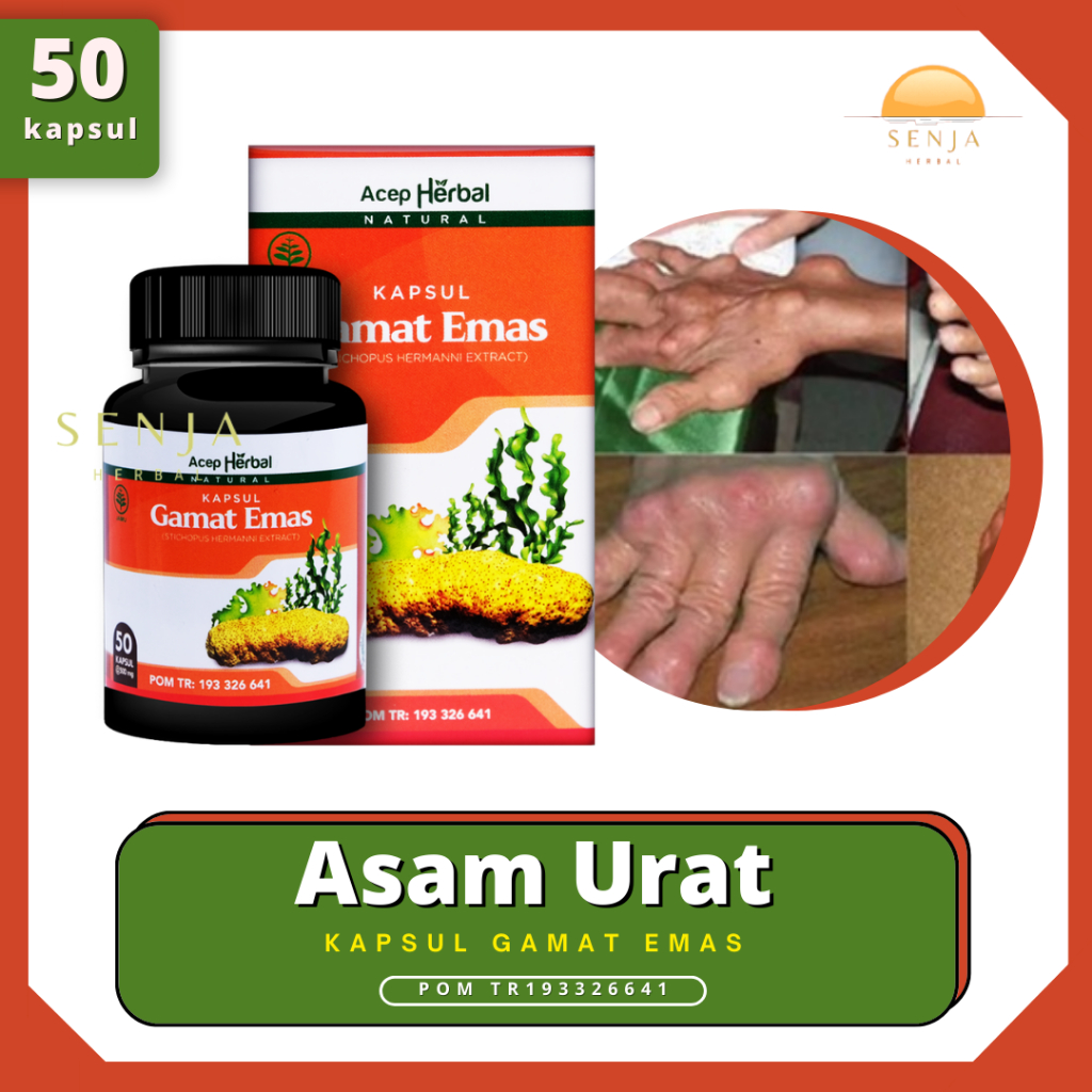 Pengobatan Asam Urat, Nyeri Sendi, Pereda Nyeri Asam Urat, Sendi Bengkak | Kapsul Gamat Emas