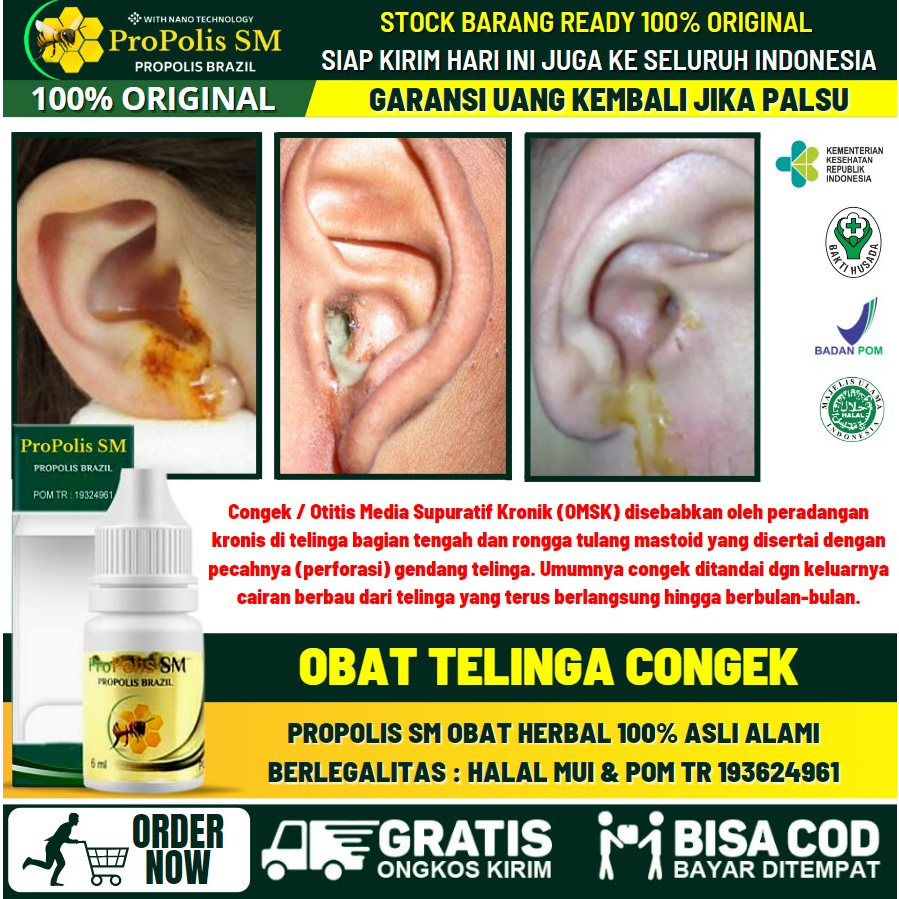 Obat Telinga Bernanah Bau & Berair, Obat Curek Telinga, Obat Agar Telinga Tidak Keluar Air, Obat Men