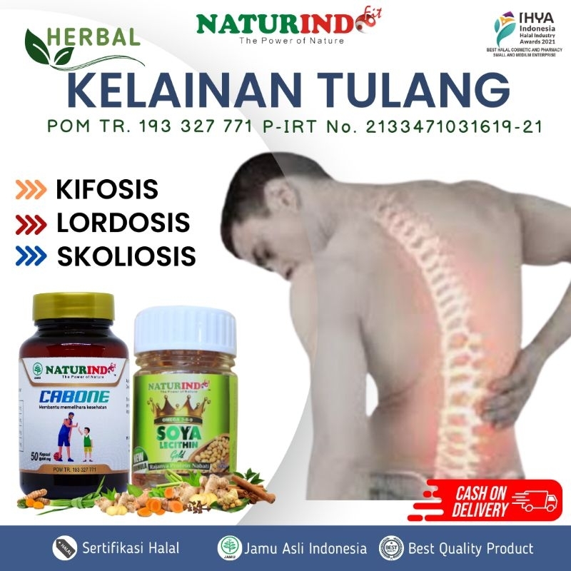 Obat kelainan tulang skoliosis lordosis kifosis