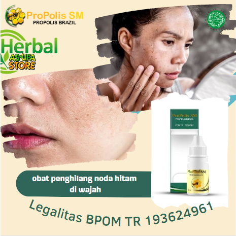 obat penghilang noda hitam di wajah, obat flek hitam di apotik, obat flek hitam di pipi, salep untuk