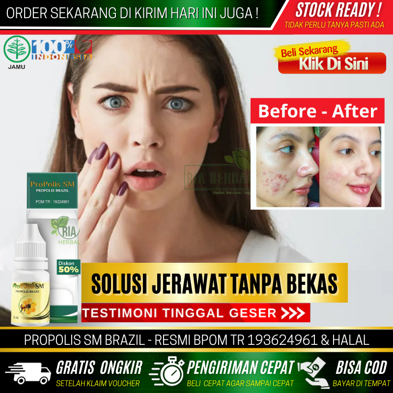 Obat Untuk Menutup Lubang Bekas Jerawat, Bisul, Bopeng, Cacar Monyet Berlubang, Penutup Bolong Bekas