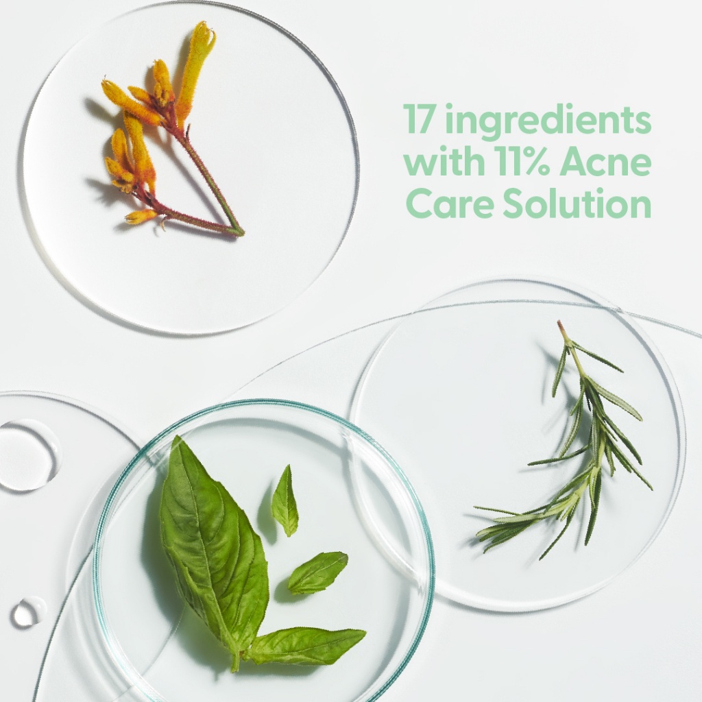 NAMA Careskin Acne Prone Face Serum|Serum Kulit Berjerawat|Serum Kulit Sensitif |Serum Acne Prone